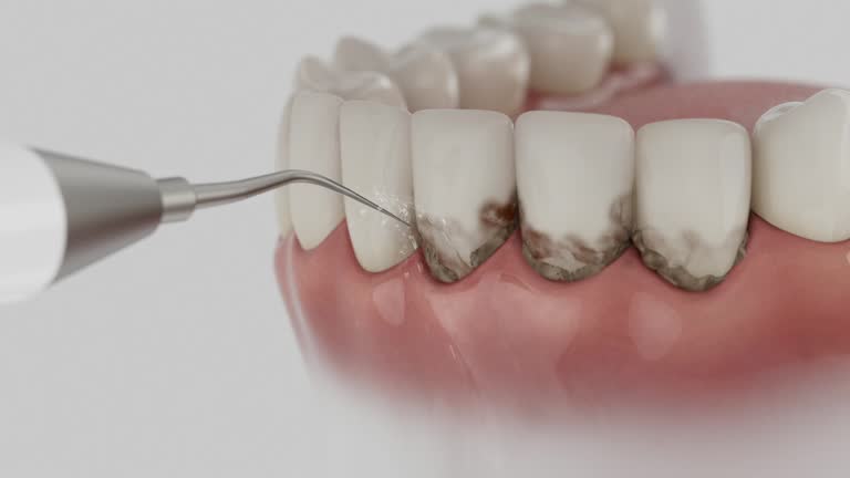 Reliable Tooth Extraction contractor in Gwinnett County County, GA by Dentist Open Now